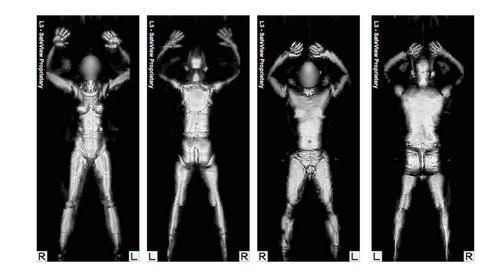 Klicken um zu vergrößern Nacktscanner, Körperscanner
