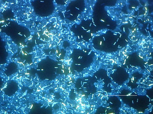 Fluoreszenzaufnahme eines Biofilms aus vielen Arten von Bakterien auf einer Oberfläche aus rostfreiem Stahl. 