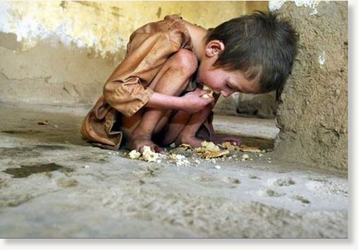 starving child
