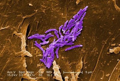 Mykobakterium
