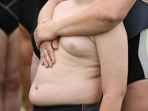 fettleibigkeit, dick, übergewicht