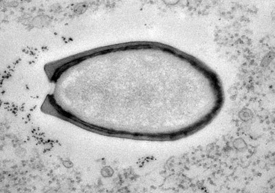 Pandoravirus, Riesenviren