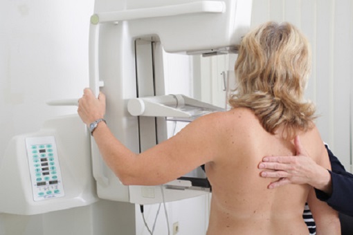 Mammografie, Screening, Brustkrebs