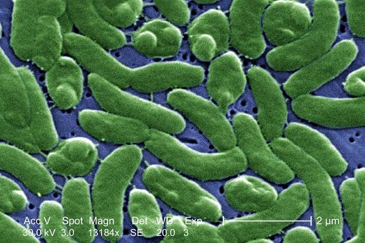 vibrio vulnificus