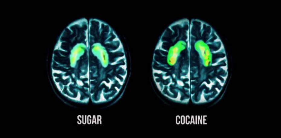 Zucker und Kokain,Gehirn auf Zucker