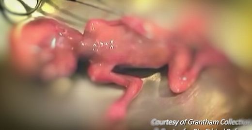 aborted baby / abgetriebenes Baby