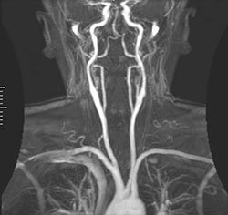 x-ray MRT Scan