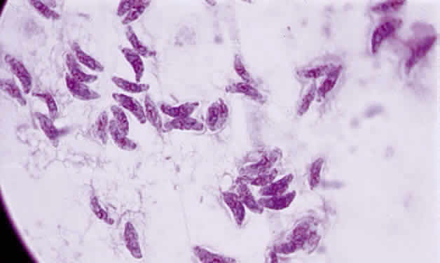 Toxoplasmosa gondii,Toxoplasmose Erreger
