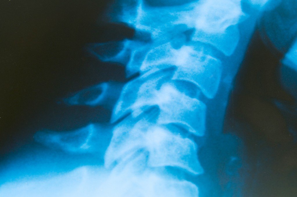 Rückenmark,Wirbelsäule