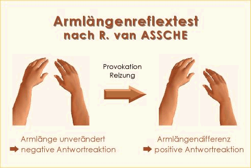 Kinesiologie Armlängenreflextest