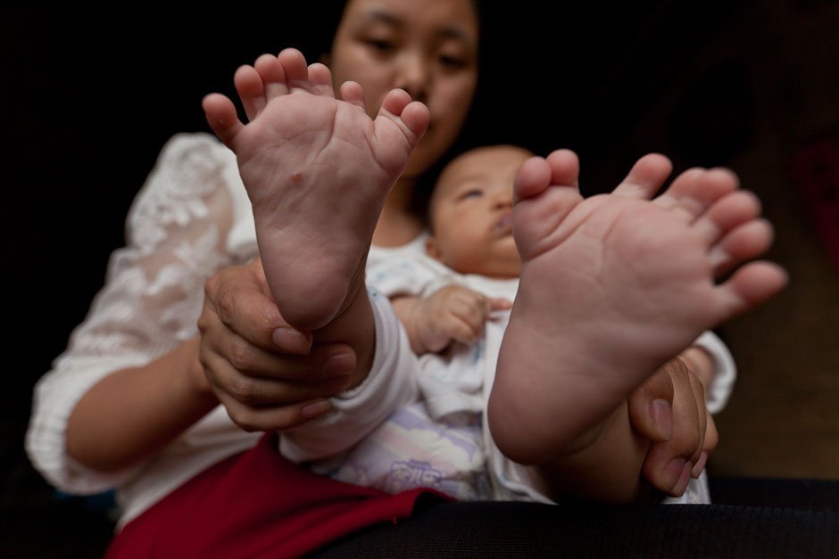 Baby in China wird mit 15 Fingern und 16 Zehen geboren .
