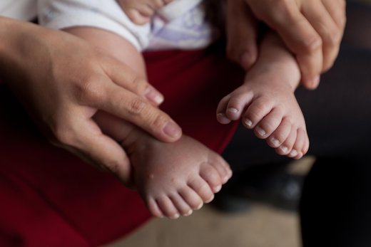 Baby in China wird mit 15 Fingern und 16 Zehen geboren .