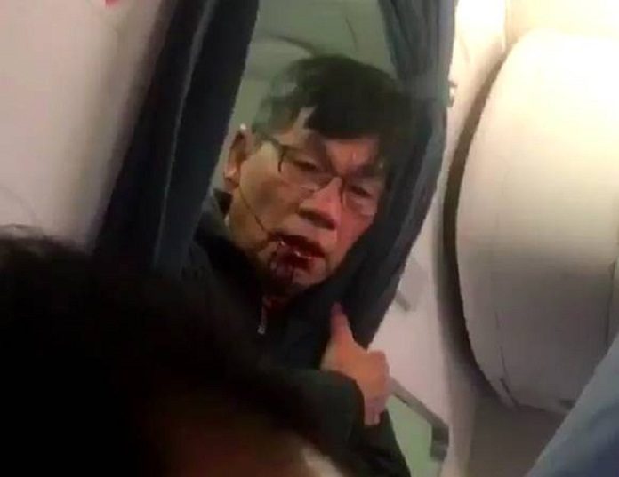 Putnika leta United Airlinesa brutalno izvukli iz aviona