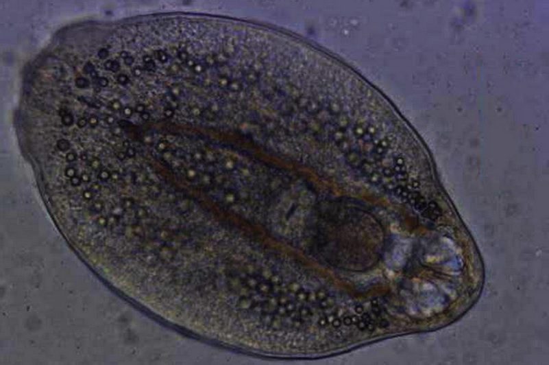 Diplostomum pseudospathaceum