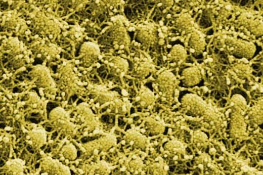 E.coli Bakterien