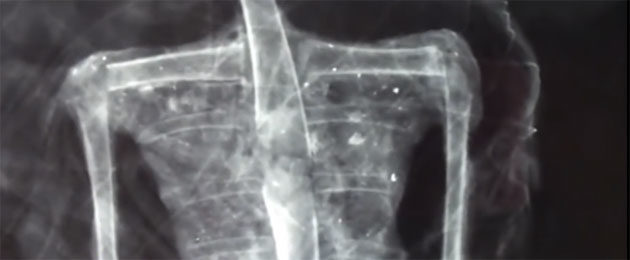 Röntgenbild Mumie