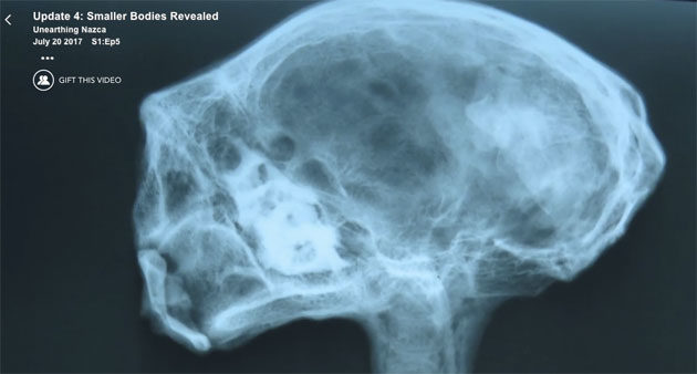 Röntgenbild Mumie Nazca