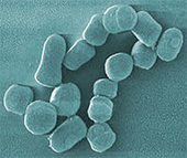 Aktinobakterien Arthrobacter