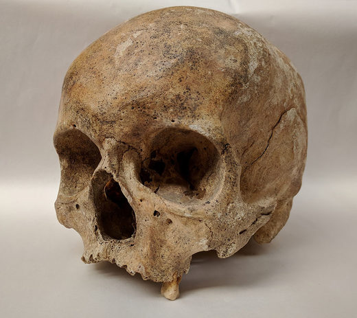 Das Forschungsteam untersuchte mittelalterliche aDNA aus Zähnen und Felsenbein, dem härtesten Knochen des Schädels