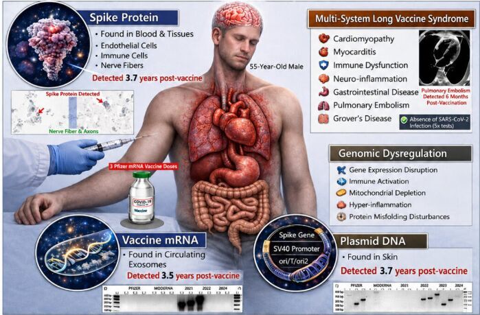 spike protein, impfumg rna, long covid, post covid