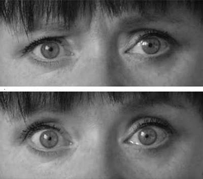 Vergleich: normaler und hypnotischer Blick