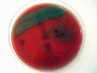 Neu entdecktes Bakterium Streptococcus tigurinus
