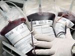 Klicken um zu vergrößern Transfusionsblutbeutel