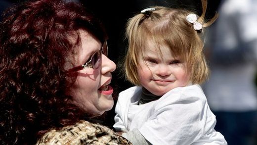 Klicken um zu vergrößern down syndrome, kind