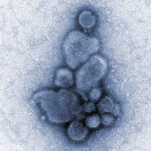 Influenza A (H7N9)