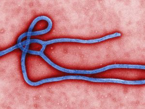 ebola virus mikroskopaufnahme