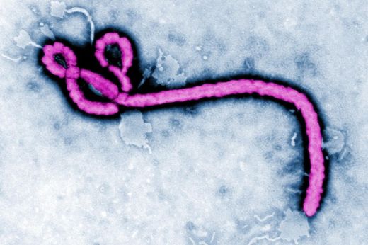 ebola